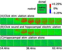図1 海馬刺激による聴覚野応答の抑制
