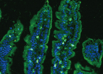 腸管の免疫機能形成の研究